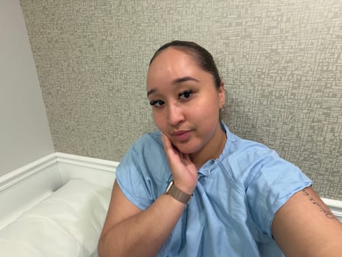 Customer photo review of WrinkleFix: Botox (First-Time)