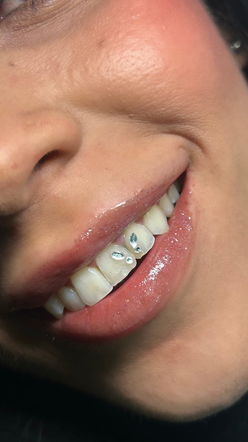 Customer photo review of Formación técnico de joyería dental online - Curso online de gemas dentales