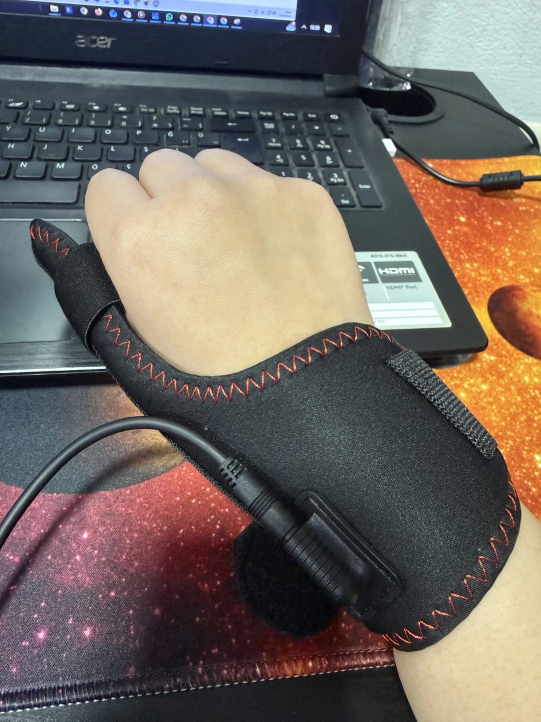 Customer photo review of Alivio Inteligente para Manos Sobrecargadas