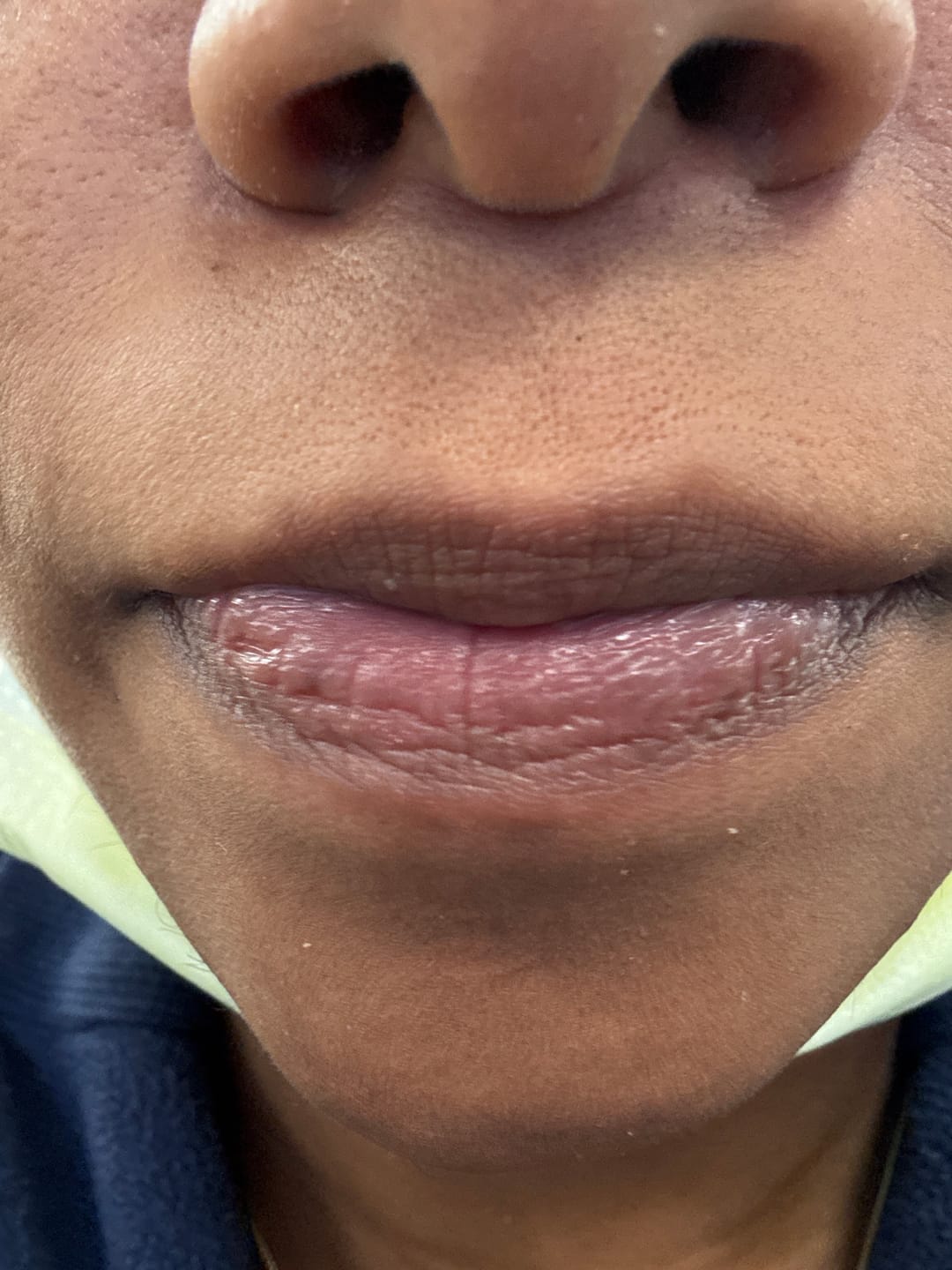 Customer photo review of Jolie Lip Brightening Cream