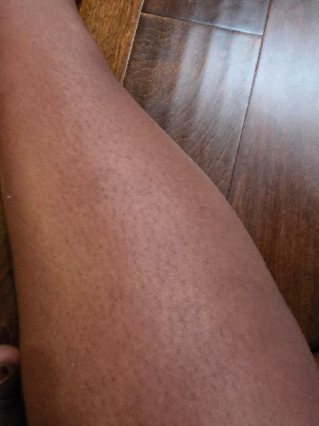 Customer photo review of Fair And White MIX Brightening Serum 30ml