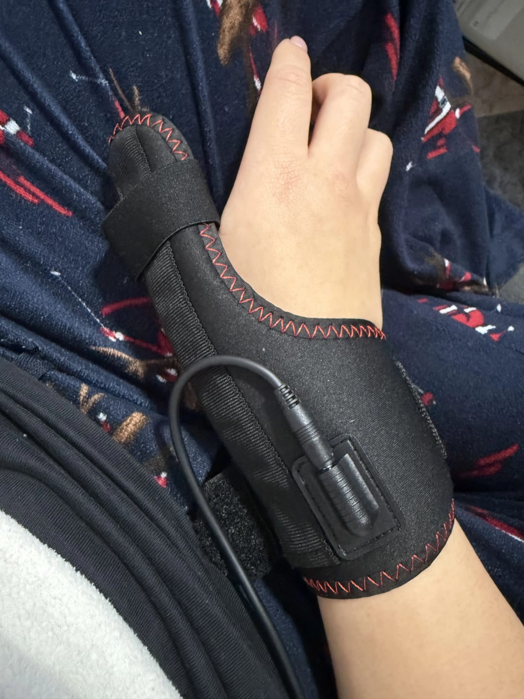 Customer photo review of Alivio Inteligente para Manos Sobrecargadas