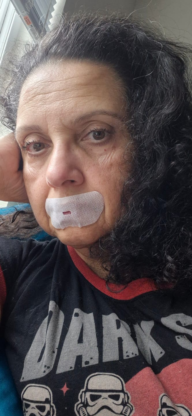 Customer photo review of oi tape™ Mouth Tape