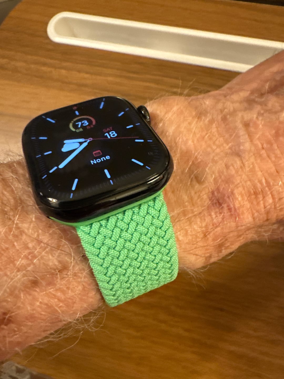 Customer photo review of Woven Loop