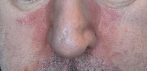 Customer photo review of Seb Natural Calming Serum