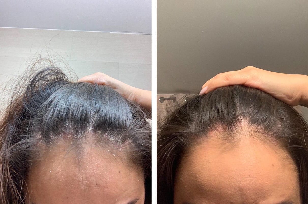 Customer photo review of Smiles & Joys Eczema and Psoriasis Herbal Cream