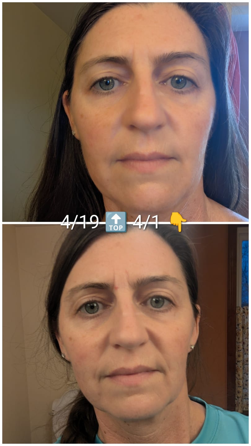 Customer photo review of Ageless Cloud Cream