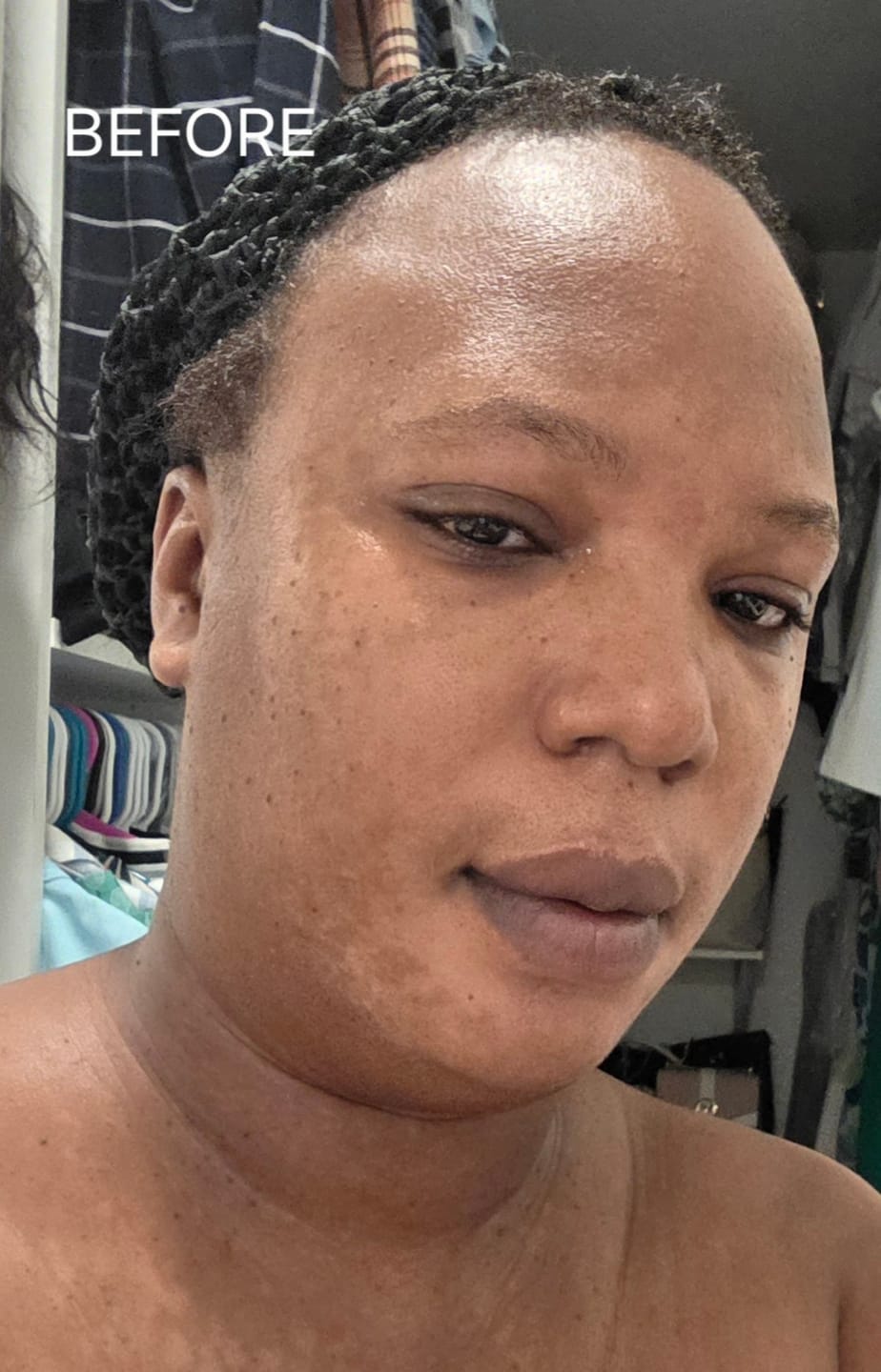 Customer photo review of Melanin Skin Bundle