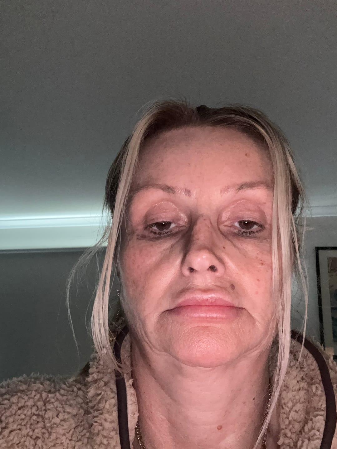 Customer photo review of SEA BUCKTHORN SERUM - 30ml