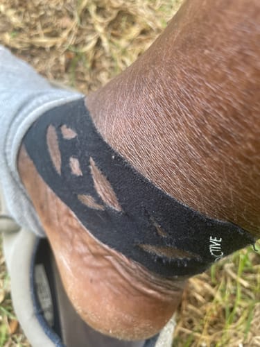 Customer photo review of Easy Kinesiology Tape (30-Day Supply)