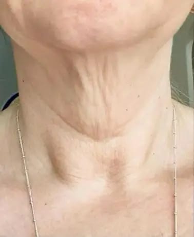 Customer photo review of Herth & Bloom 7-in-1 LED Facial Sculptor