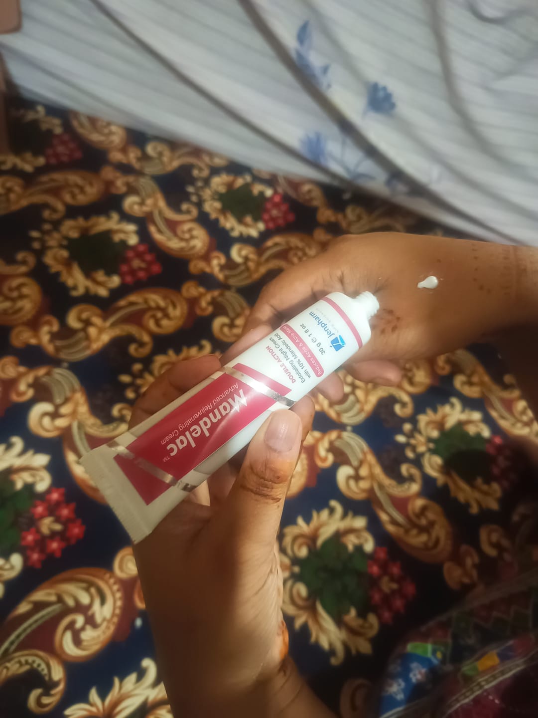 Customer photo review of MandelAC Cream