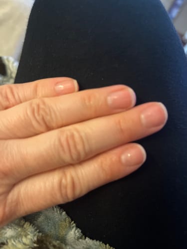 Customer photo review of TryTallow™ Grass-Fed Tallow Balm (4oz)