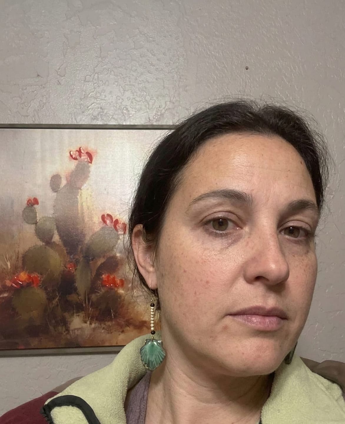 Customer photo review of Complete Gut Repair & Hormonal Balance System for Female Acne