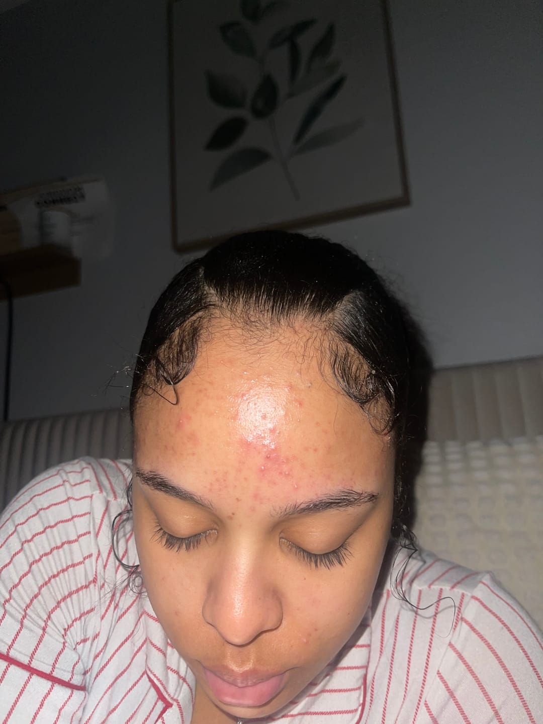 Customer photo review of Duo Skincare Bundle