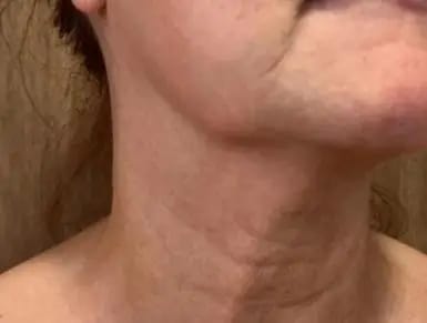 Customer photo review of Herth & Bloom 7-in-1 LED Facial Sculptor