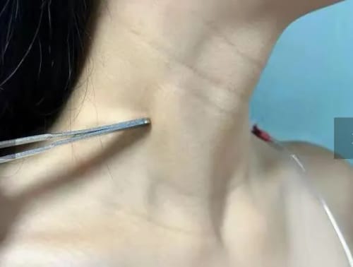 Customer photo review of Herth & Bloom 7-in-1 LED Facial Sculptor