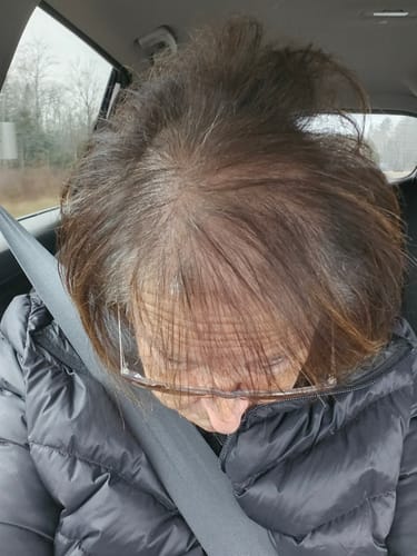 A customer's hair viewed from above showing thinning at the crown, related to a review for the organic shampoo.