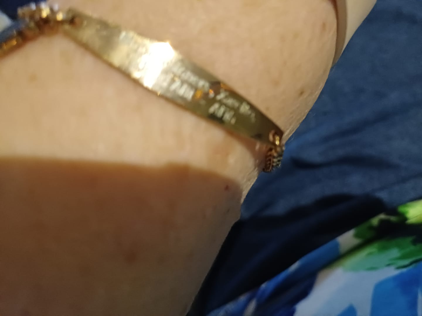 Customer photo review of Rose Gold Colour Medical Alert Bracelet with Medical Charm