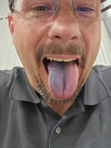 Close-up of a reviewer showing their tongue, which is blue after taking Blue Cannatine.