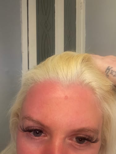 Customer photo review of Seb Natural Calming Serum