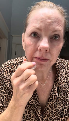 Reviewer holding the Seranova Microneedling Infusion System to their cheek.