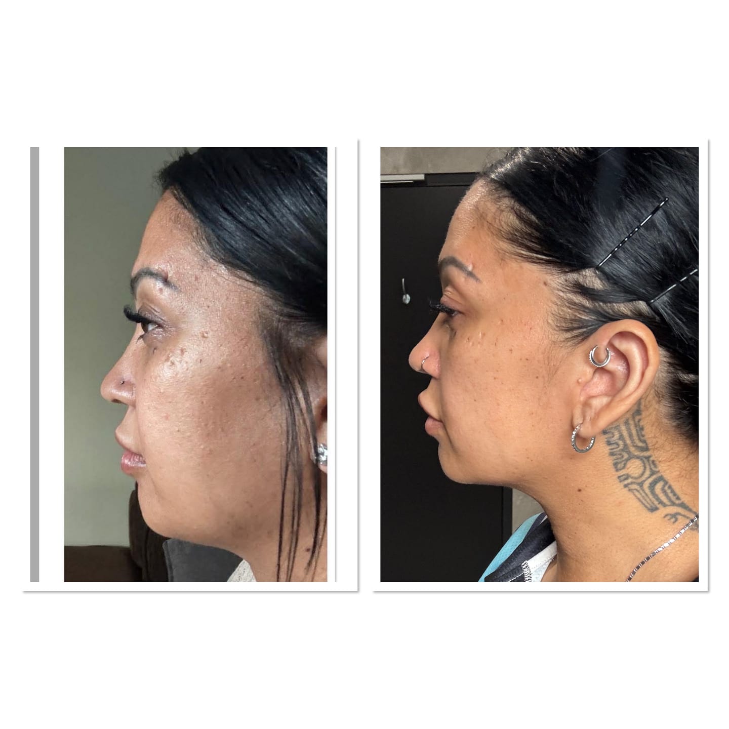 Customer photo review of Essentials Bundle