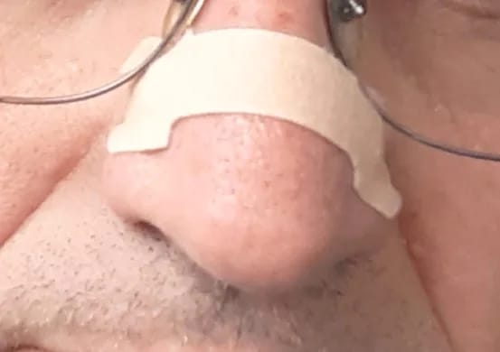 Customer photo review of PurelyGoods Neusstrips (45 stuks)