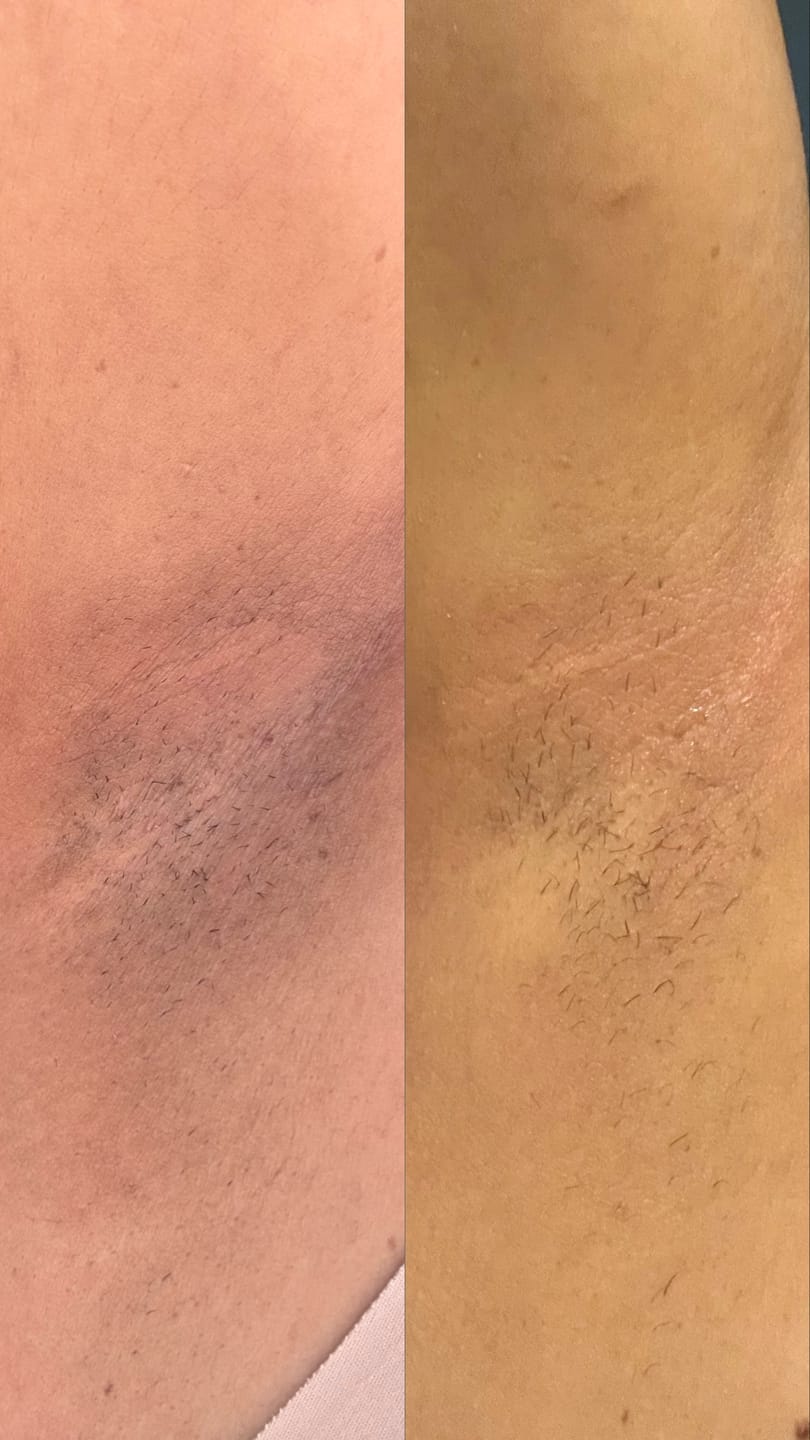 Customer photo review of Healgel Restorative: Gel Hidratante Facial