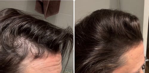 Customer photo review of VITAFOAM ™ Hair Growth Formula