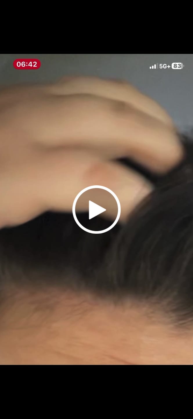 Customer video review of Pre-Wash Fortifying Rosemary Oil for Scalp