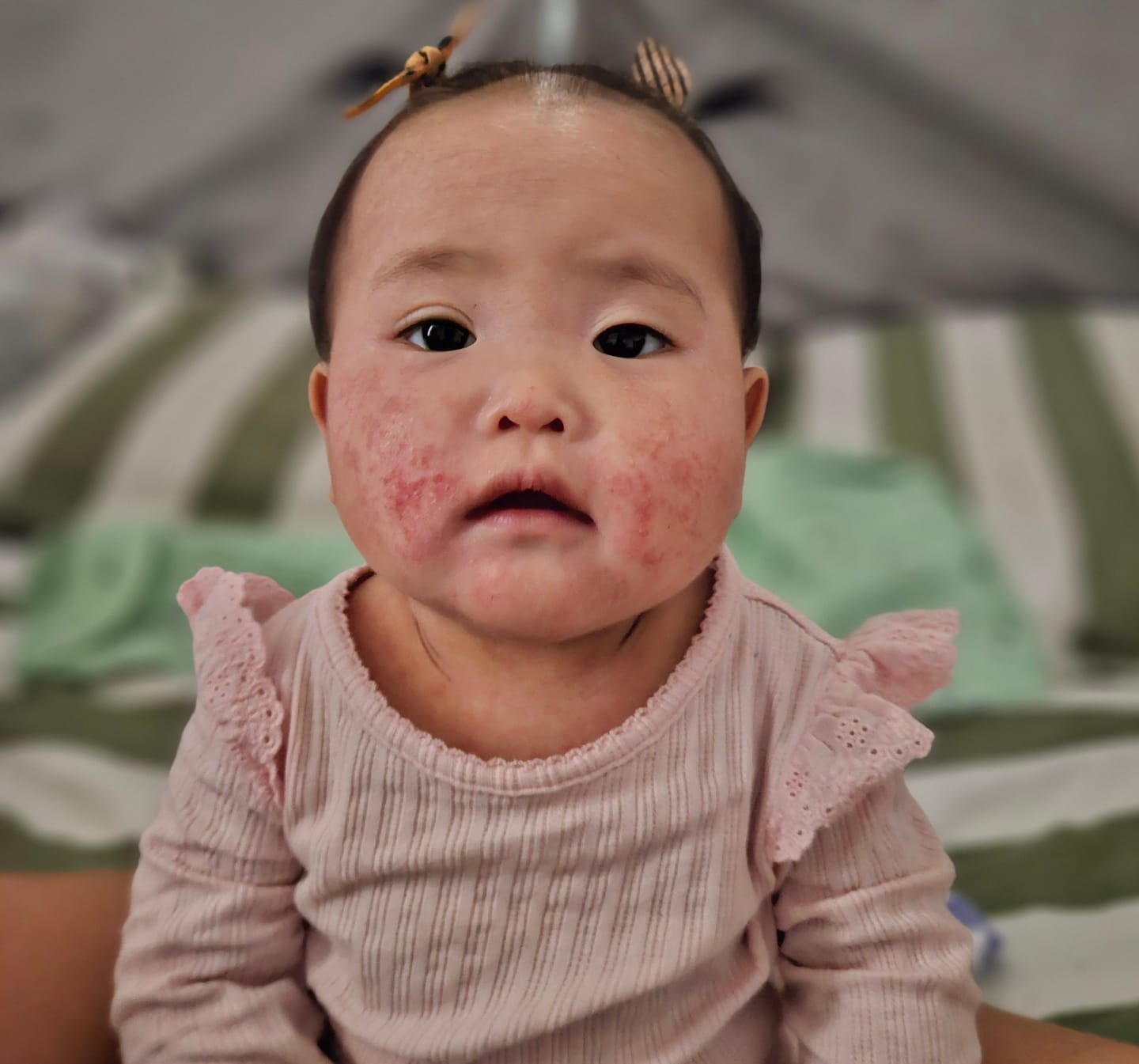 Customer photo review of Hemp Seed Rescue Butter