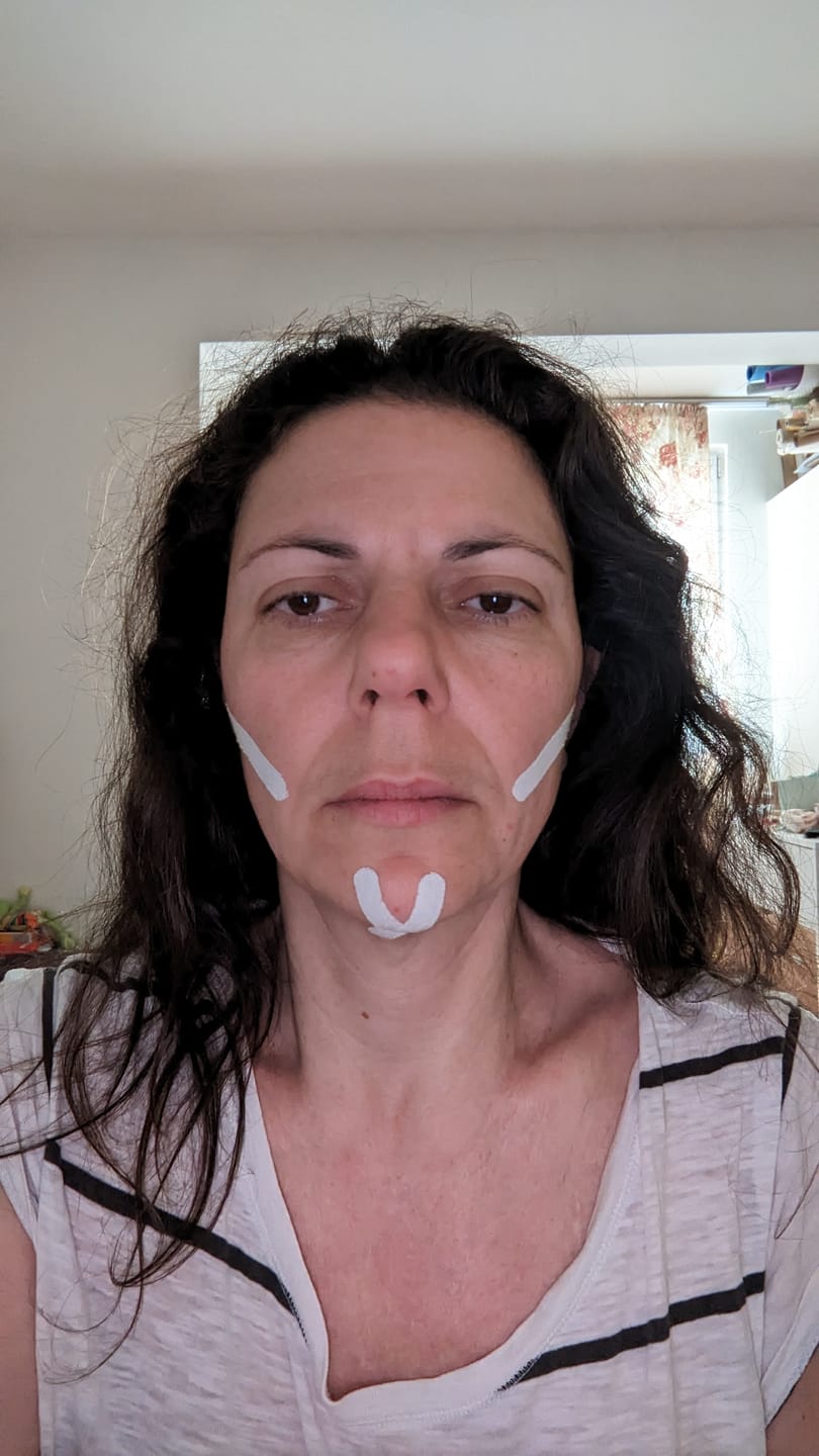 Customer photo review of Zygo Tape - Facial Sculpting & Anti-Aging Tape For Women