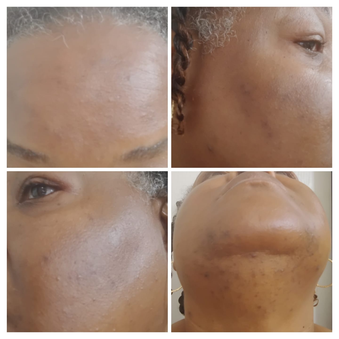 Customer photo review of Melanin Skin Bundle
