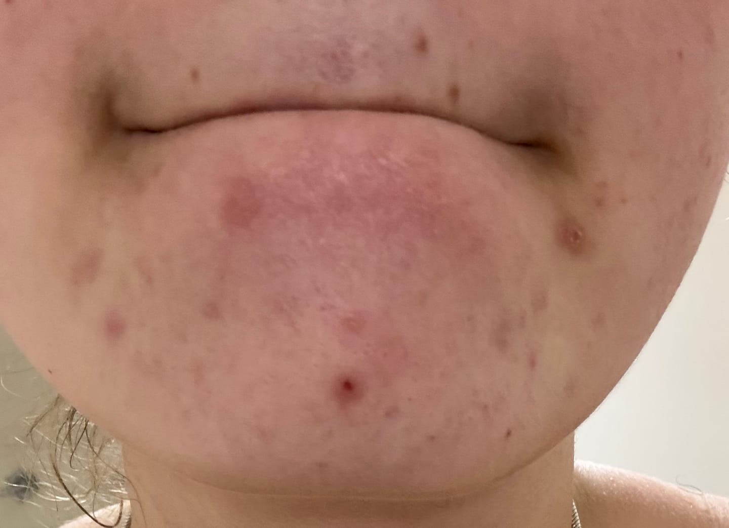 Customer photo review of ⚡ Turmeric Vitamin C Clay Mask