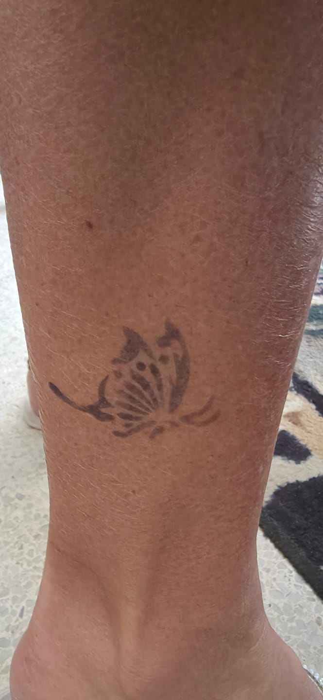 Customer photo review of Jagua Tattoo Gel Kit – 1 oz Semi-Permanent Tattoo Ink | Long-Lasting Temporary Tattoo (1-2 Weeks)