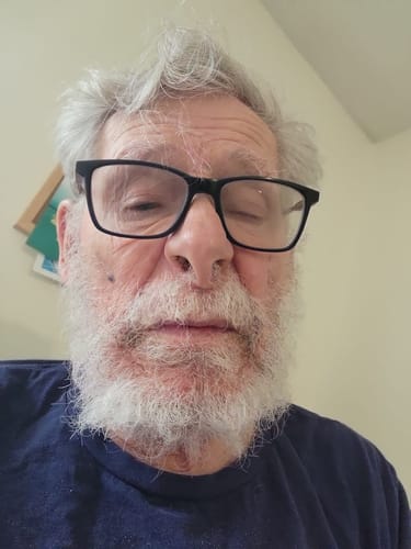 Customer photo review of ClarityMax - The Smallest EVER Wireless Hearing Aid