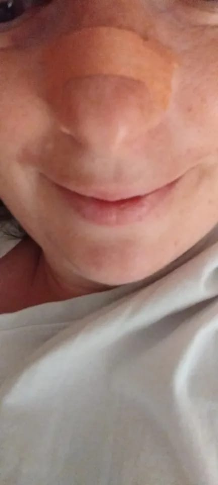 Customer photo review of PurelyGoods Neusstrips (45 stuks)