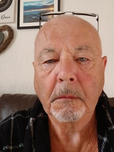 Customer photo review of Seb Natural Soothing Balm