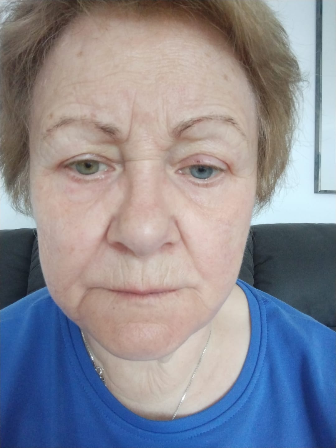 Customer photo review of Repair Balm No.3
