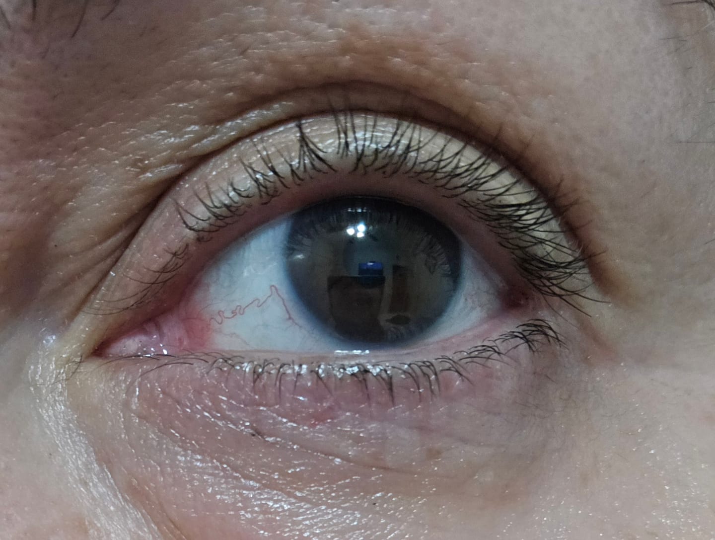 Customer photo review of Suero para pestañas y cejas