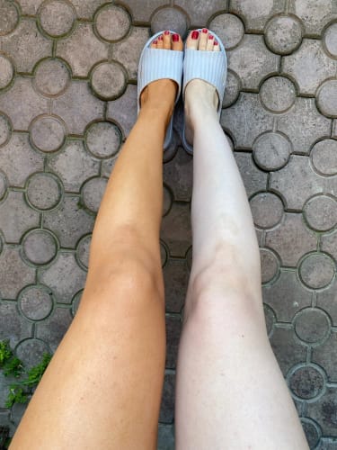 Customer photo review of Lumi Legs