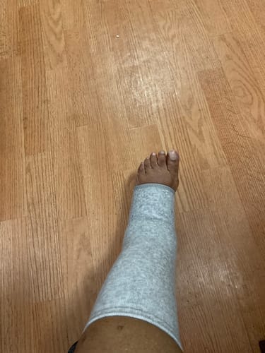 Customer photo review of StepCare Bamboo Foot Sleeve