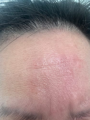 Customer photo review of Seb Natural Calming Serum