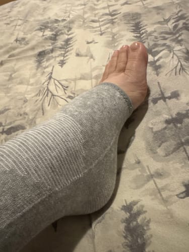 Customer photo review of StepCare Bamboo Foot Sleeve