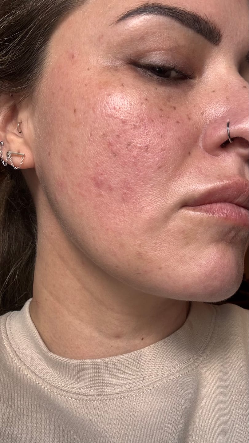Customer photo review of Turmeric Fade & Glow Bar.