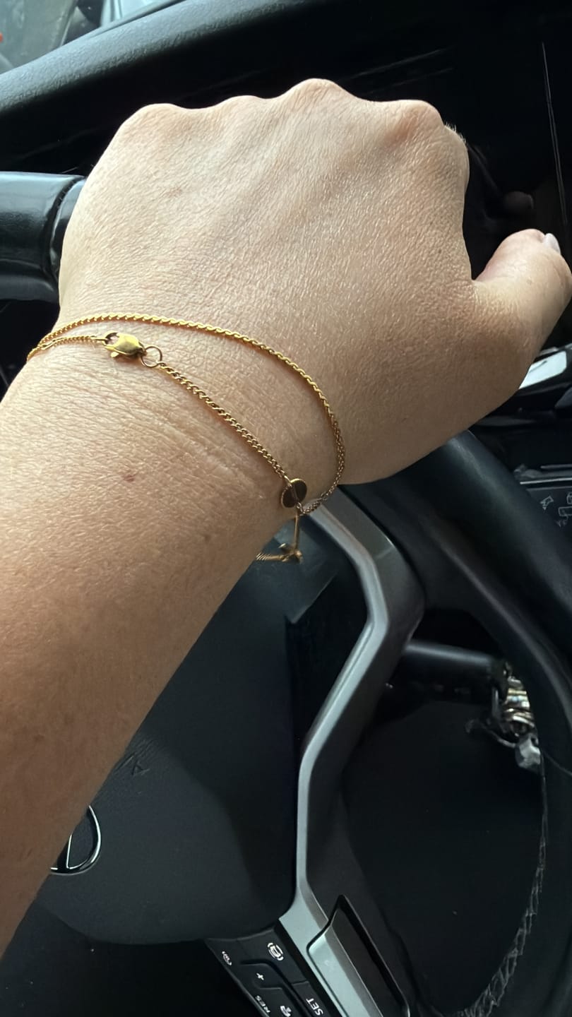 Customer photo review of Permanent Armband - dein everbond in Köln