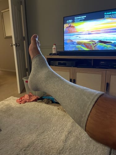 Customer photo review of StepCare Bamboo Foot Sleeve