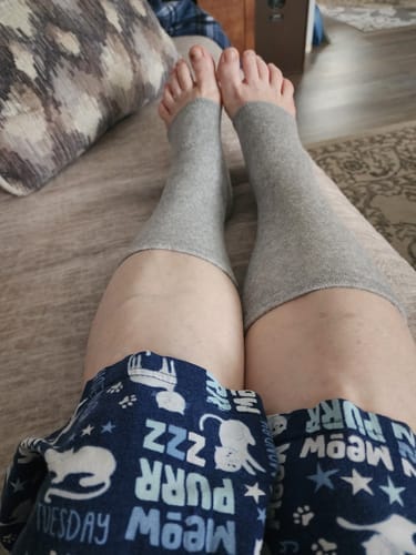 Customer photo review of StepCare Bamboo Foot Sleeve