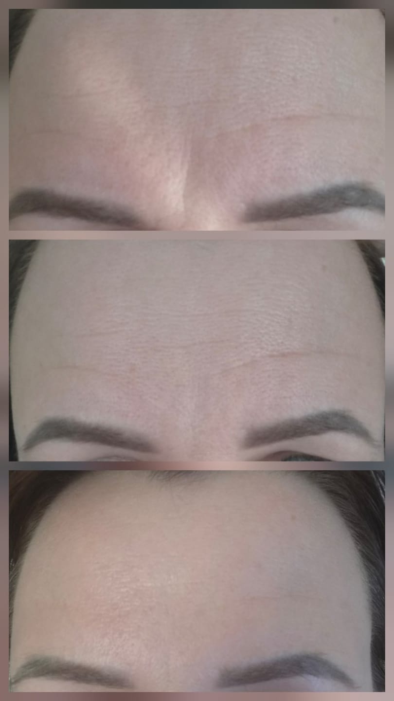 Customer photo review of Inkapsuliuoto retinolio serumas